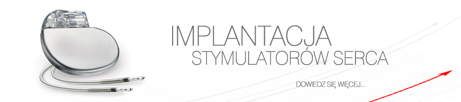 implantacja stymulatorów serca